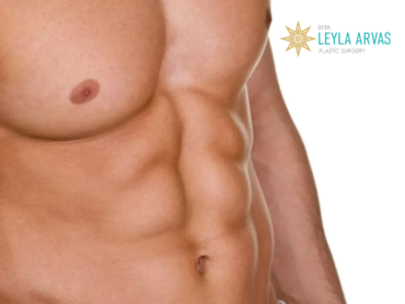 Abdominoplasty For Men (Tummy Tuck)