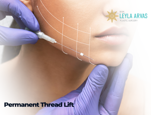 Permanent Thread Lift